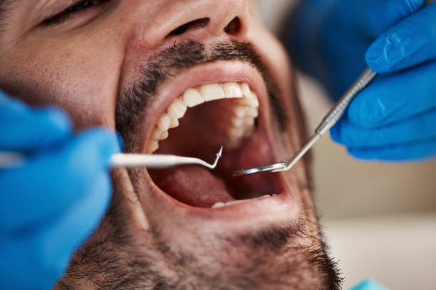 Best Broken or Cracked Tooth Emergency Dentist in Perry, IA