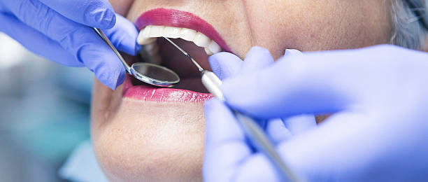 Best Emergency Dental Care for Abscessed Tooth in Perry, IA